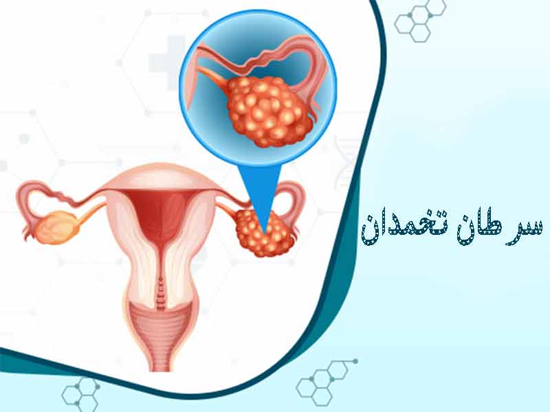 خطر سرطان تخم دان درچه مشاغلی وجود دارد